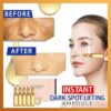 Instant Dark Spot Lifting-Ampulle