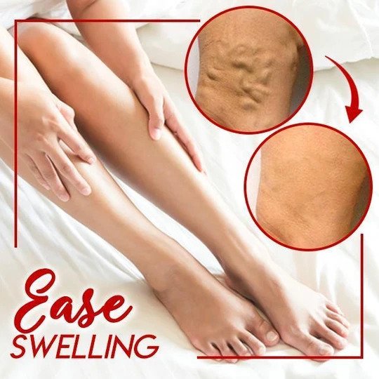 LegsRelief Beruhigungscreme – Bild 2