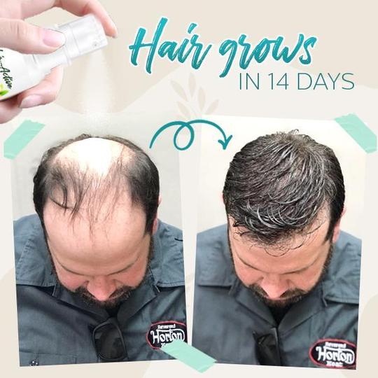 Haaraktives Wurzel-Boost-Ingwer-Spray – Bild 2