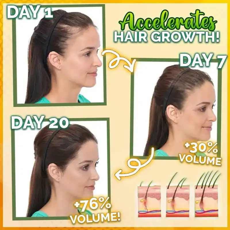 10X-Regro Starkes Haarserum – Bild 2