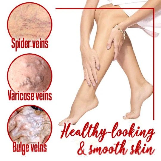 LegsRelief Beruhigungscreme – Bild 3