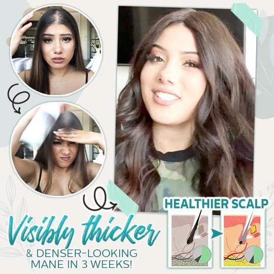 Haaraktives Wurzel-Boost-Ingwer-Spray – Bild 4