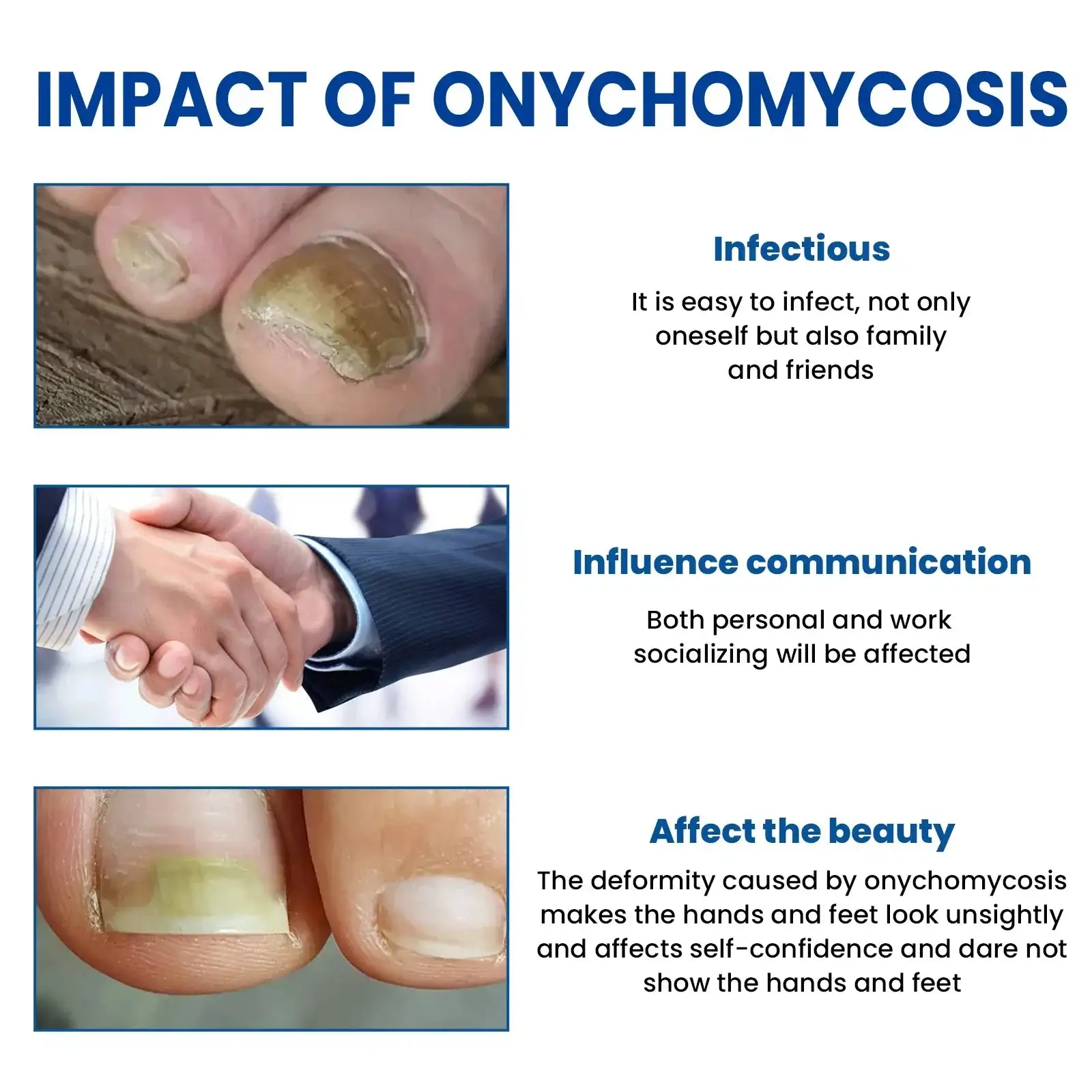 Reparaturpflaster gegen Nagelpilz – Bild 2