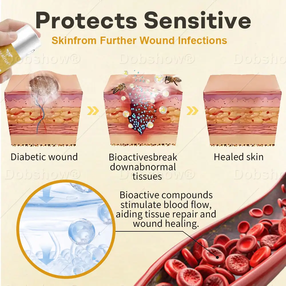 GlucoShield Bienengift-Wundspray – Bild 3