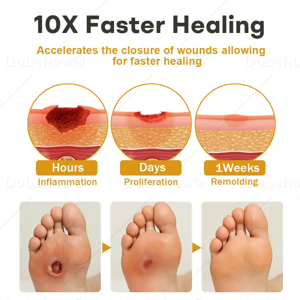 GlucoShield Bienengift-Wundspray – Bild 4